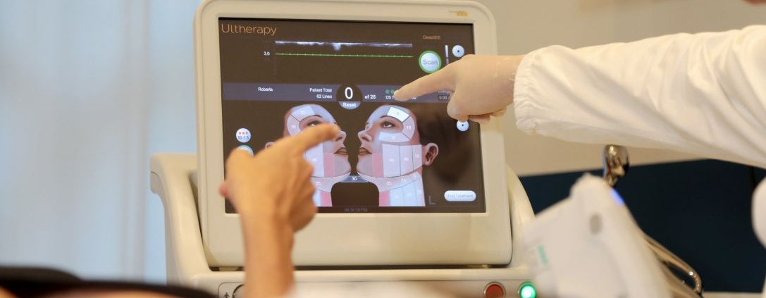 Visualizzazione ecografica nel lifting ad ultrasuoni microfocalizzati