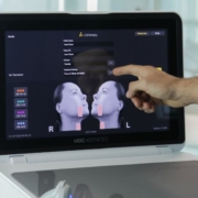 Integrare lo skinlifting Ultherapy PRIME® in studio Integrare lo skinlifting Ultherapy PRIME® in studio: perché?